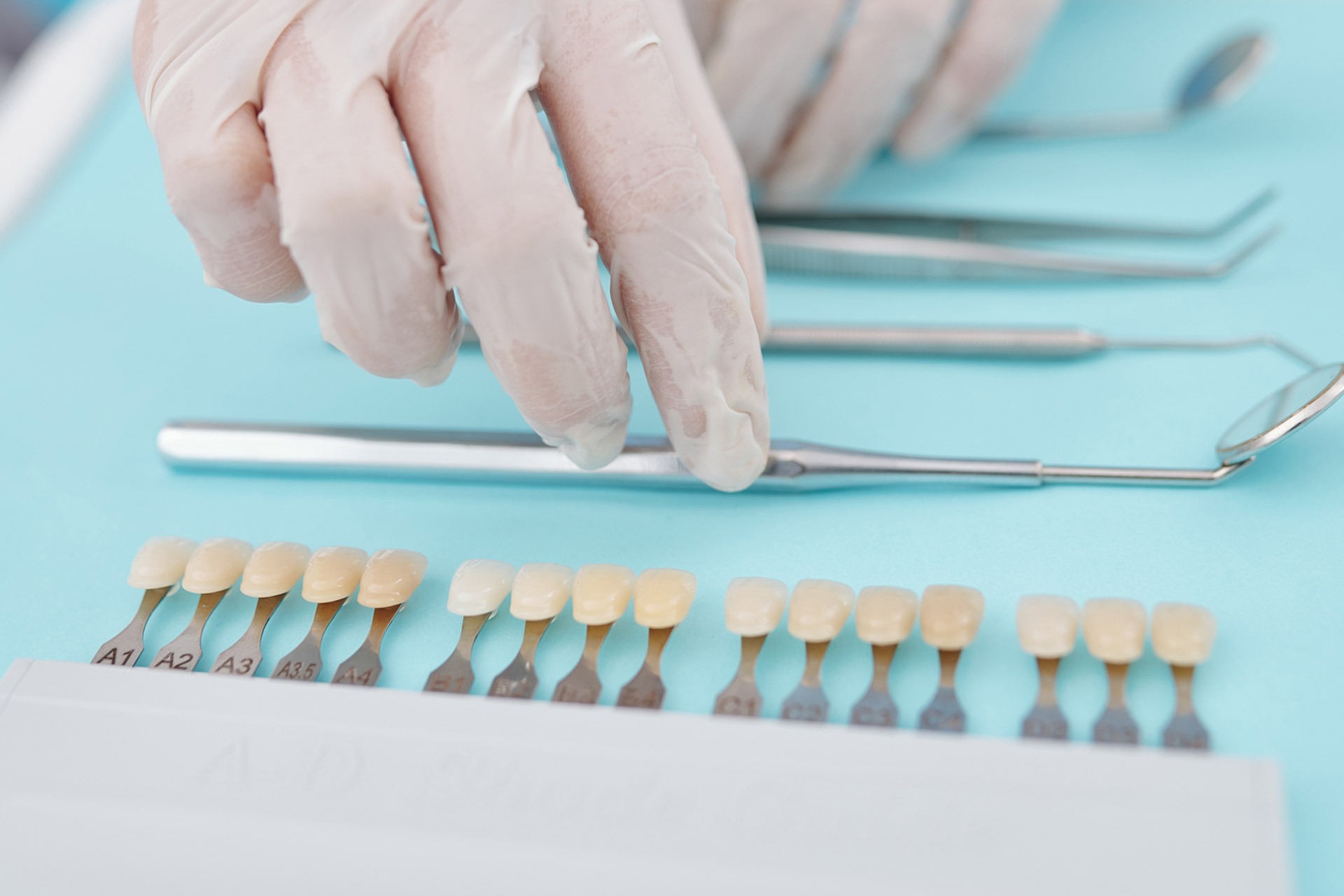 Dental veneers