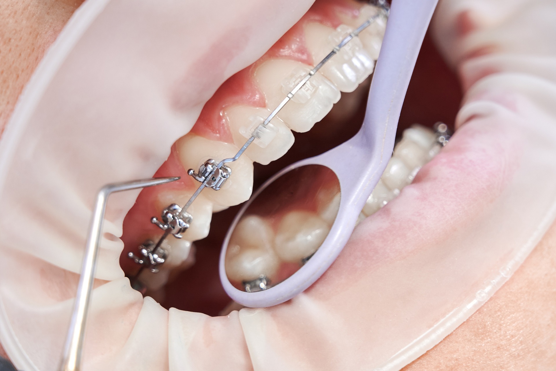 Orthodontics