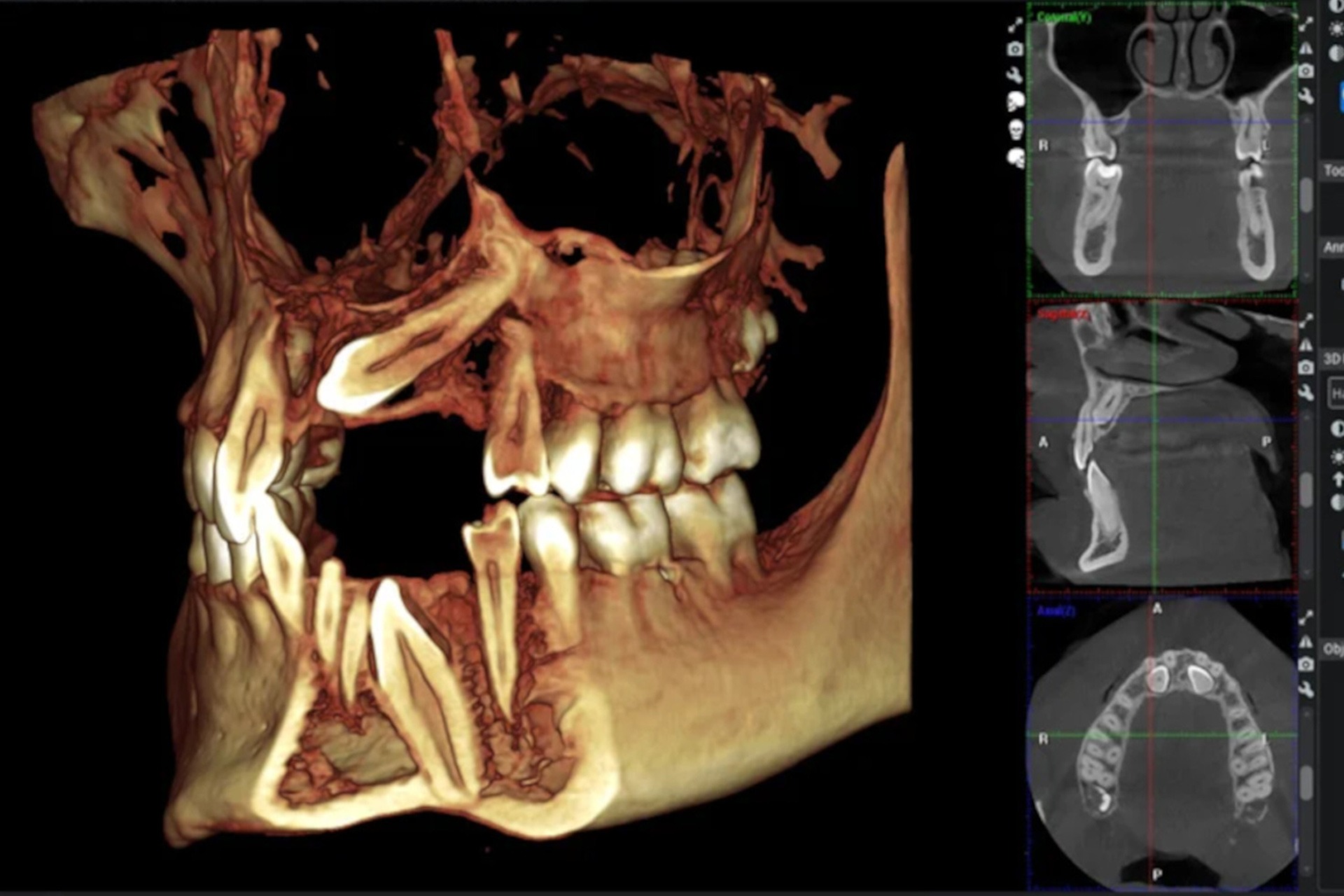 Radiography